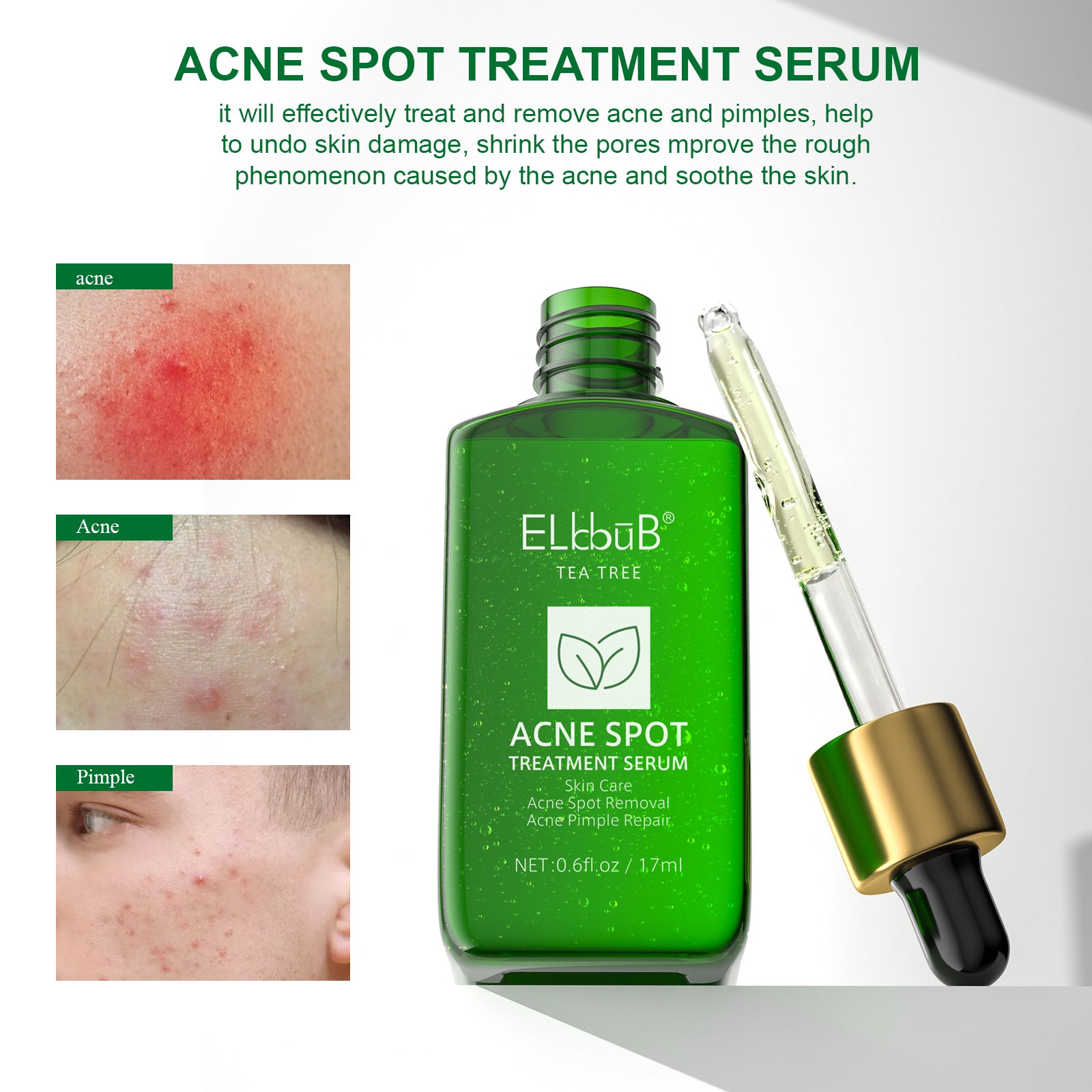ELBBUB Acne Spot Treatment Serum, Tea Tree, 17ml