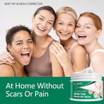 ELAIMEI Natural Herbal Skin Tag Remover Cream, 100g