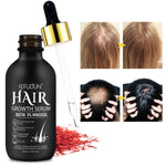 SEFUDUN Hair Growth Serum + Derma Roller Kit