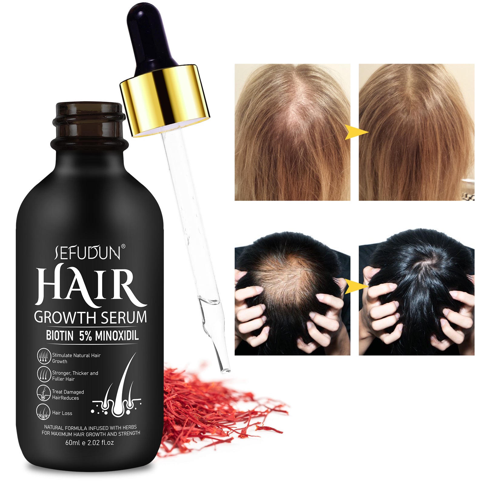 SEFUDUN Hair Growth Serum + Derma Roller Kit