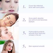 Elaimei Removal Acne Pimple Patches Plasters Face Skin Dot Stickers Cover Treatment Hydrocolloid Spot Blemishes Comedone Remover Cleaner (24 pcs )