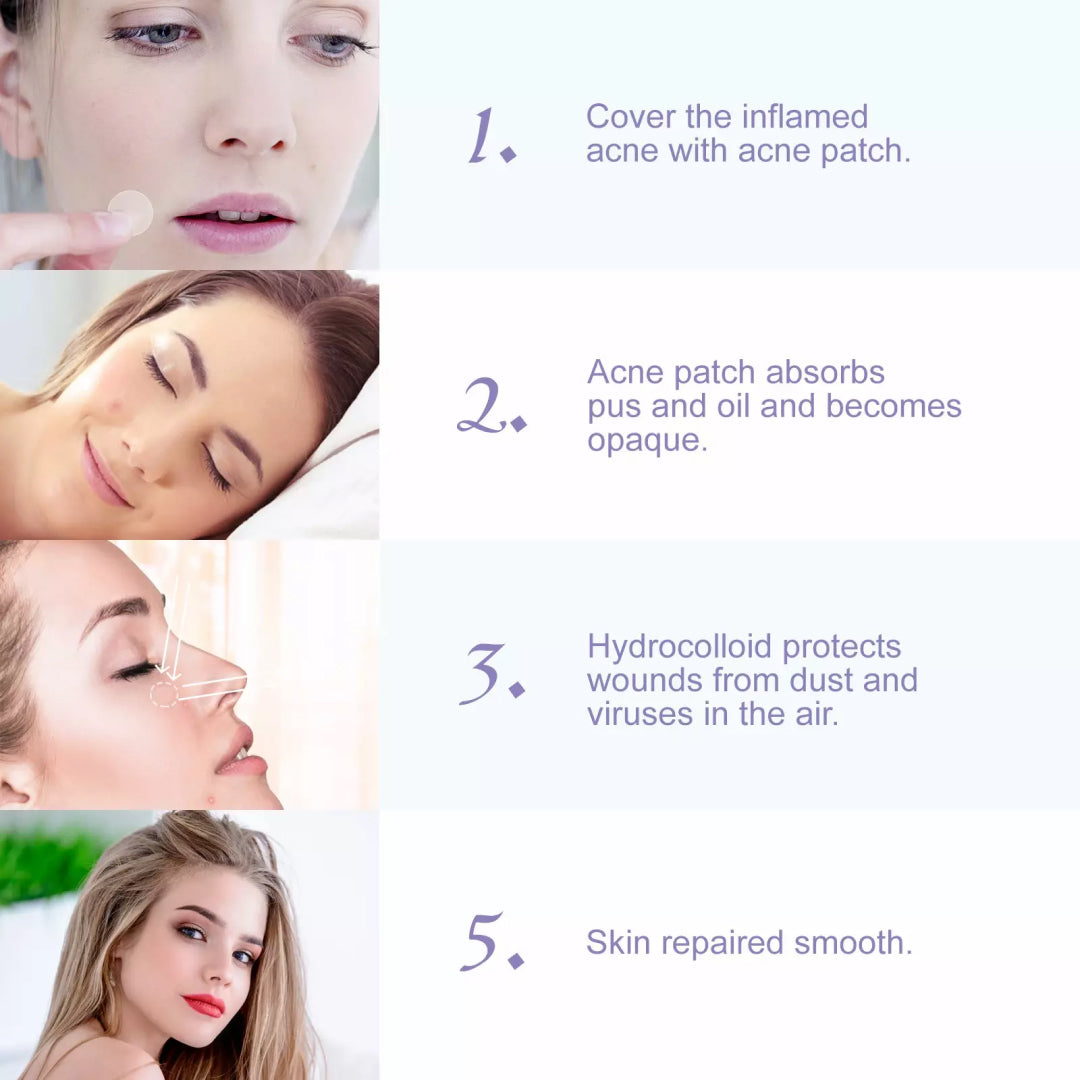 Elaimei Removal Acne Pimple Patches Plasters Face Skin Dot Stickers Cover Treatment Hydrocolloid Spot Blemishes Comedone Remover Cleaner (24 pcs )