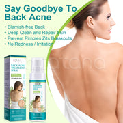 ELAIMEI Natural Body Back Acne Treatment, 120ml