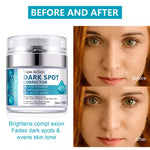 ELAIMEI Dark Spot Corrector, Whitening Cream 50ml