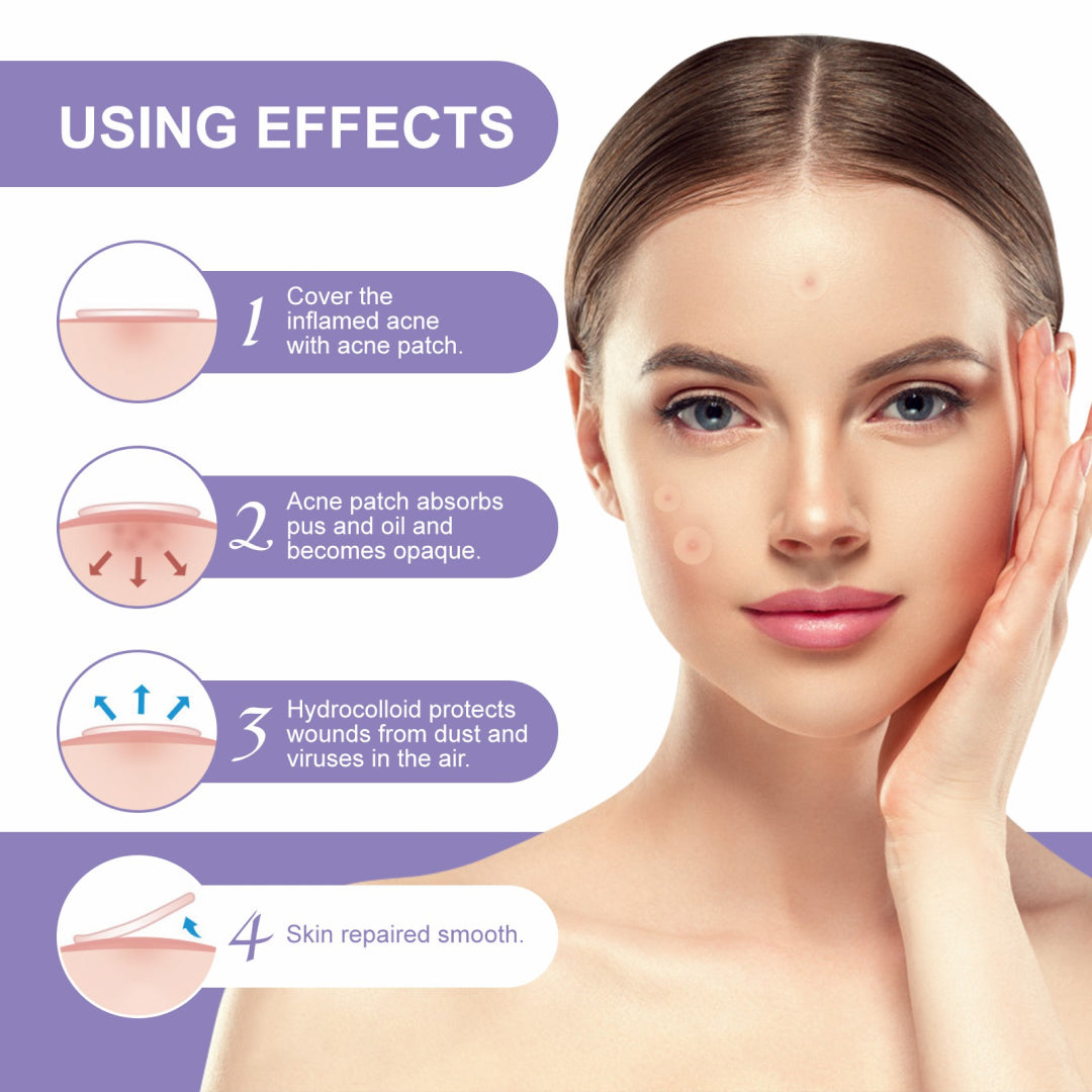 Elaimei Removal Acne Pimple Patches Plasters Face Skin Dot Stickers Cover Treatment Hydrocolloid Spot Blemishes Comedone Remover Cleaner (24 pcs )