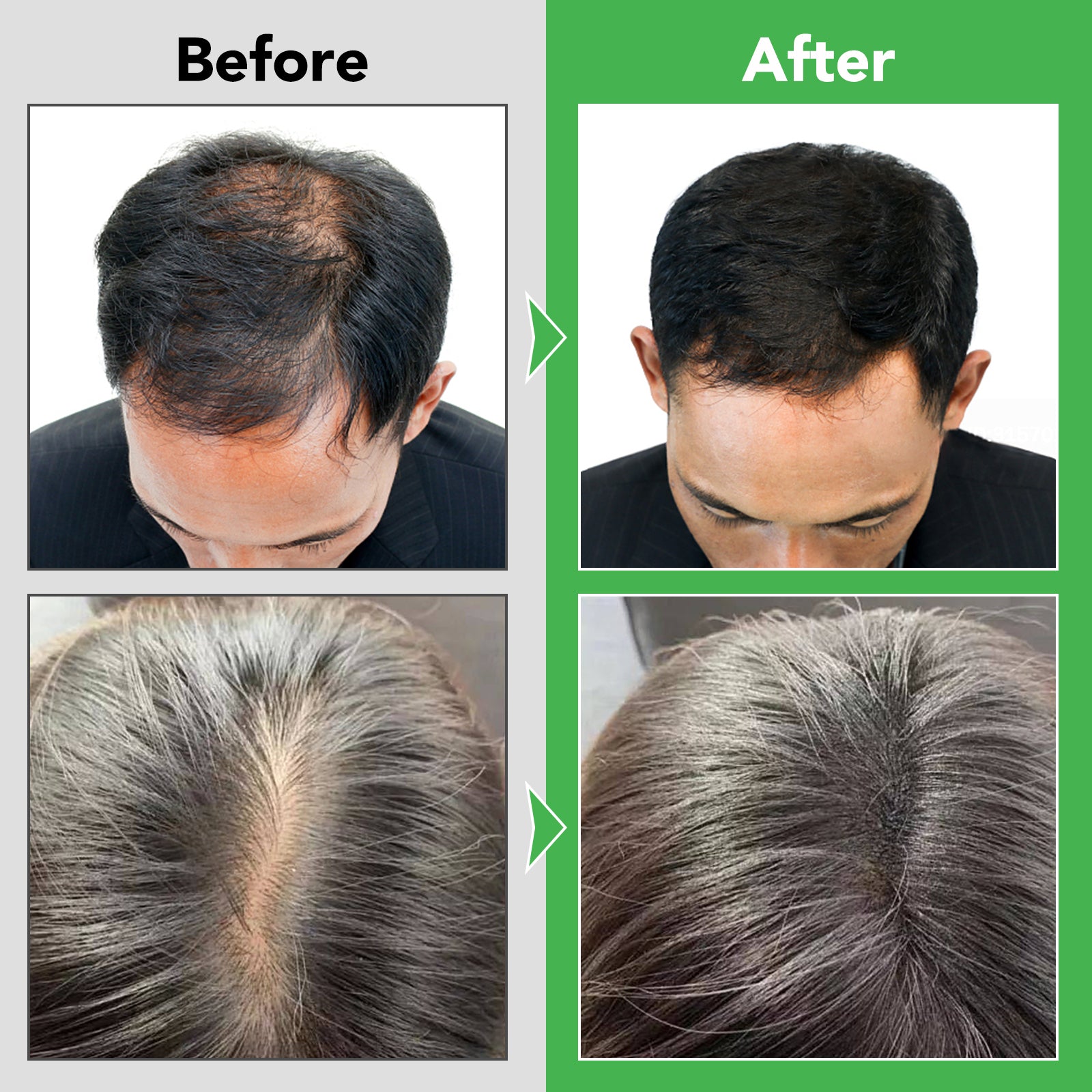 ALIVER Rosemary Hair Growth Shampoo, 300ml