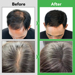ALIVER Rosemary Hair Growth Shampoo, 300ml