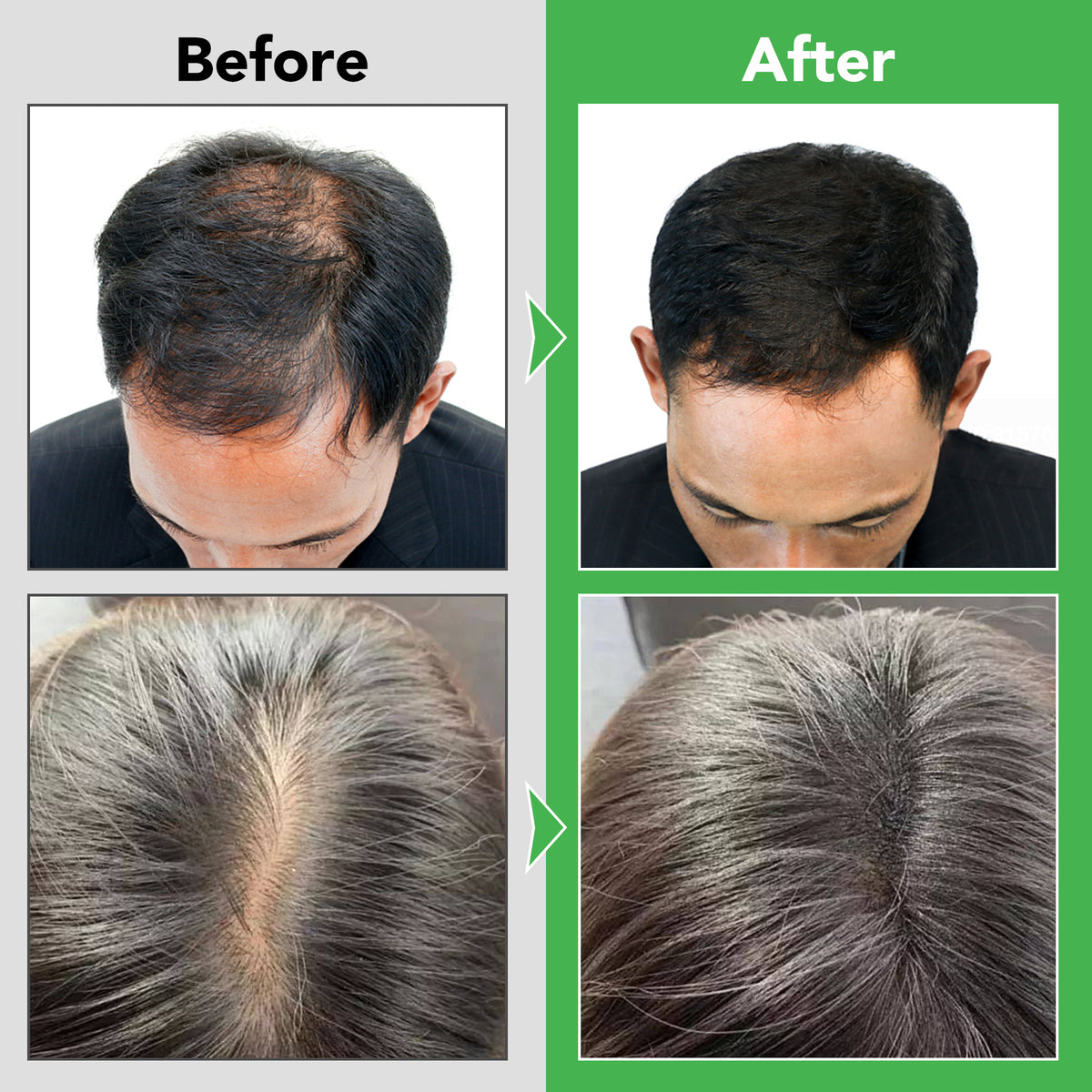 ALIVER Rosemary Hair Growth Shampoo, 300ml