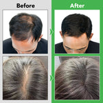 ALIVER Rosemary Hair Growth Shampoo, 300ml