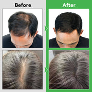 ALIVER Rosemary Hair Growth Shampoo, 300ml