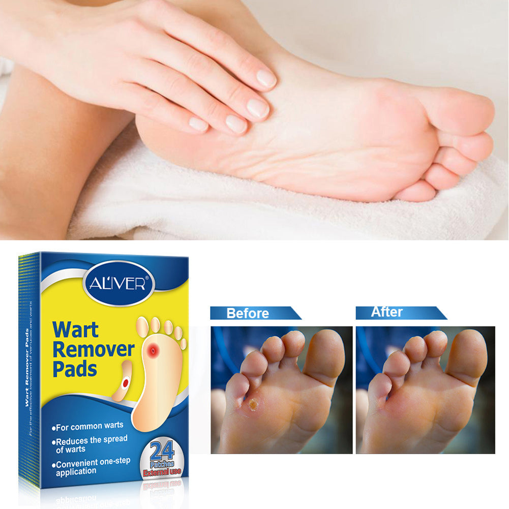 Aliver Foot Corn Wart Remover Pads 24pcs Plasters