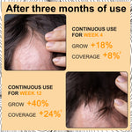 ELAIMEI Hair Regrowth Foam, 60ml