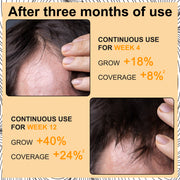 ELAIMEI Hair Regrowth Foam, 60ml