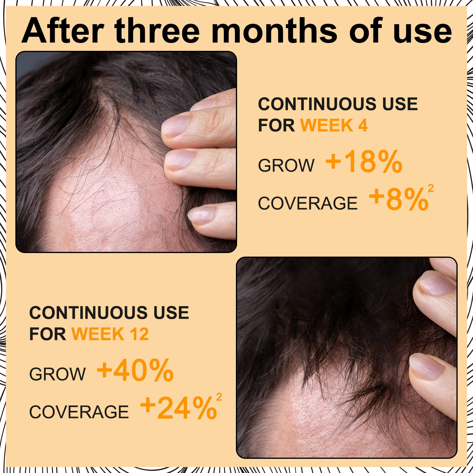 ELAIMEI Hair Regrowth Foam, 60ml