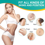 ALIVER 2in1 Skin Tag Remover Kit