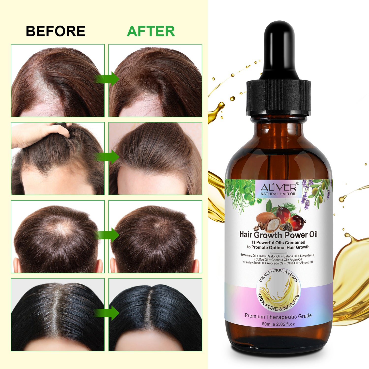 ALIVER Pure Natural Hair Growth Power Oil, 60ml