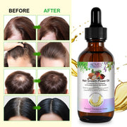 ALIVER Pure Natural Hair Growth Power Oil, 60ml