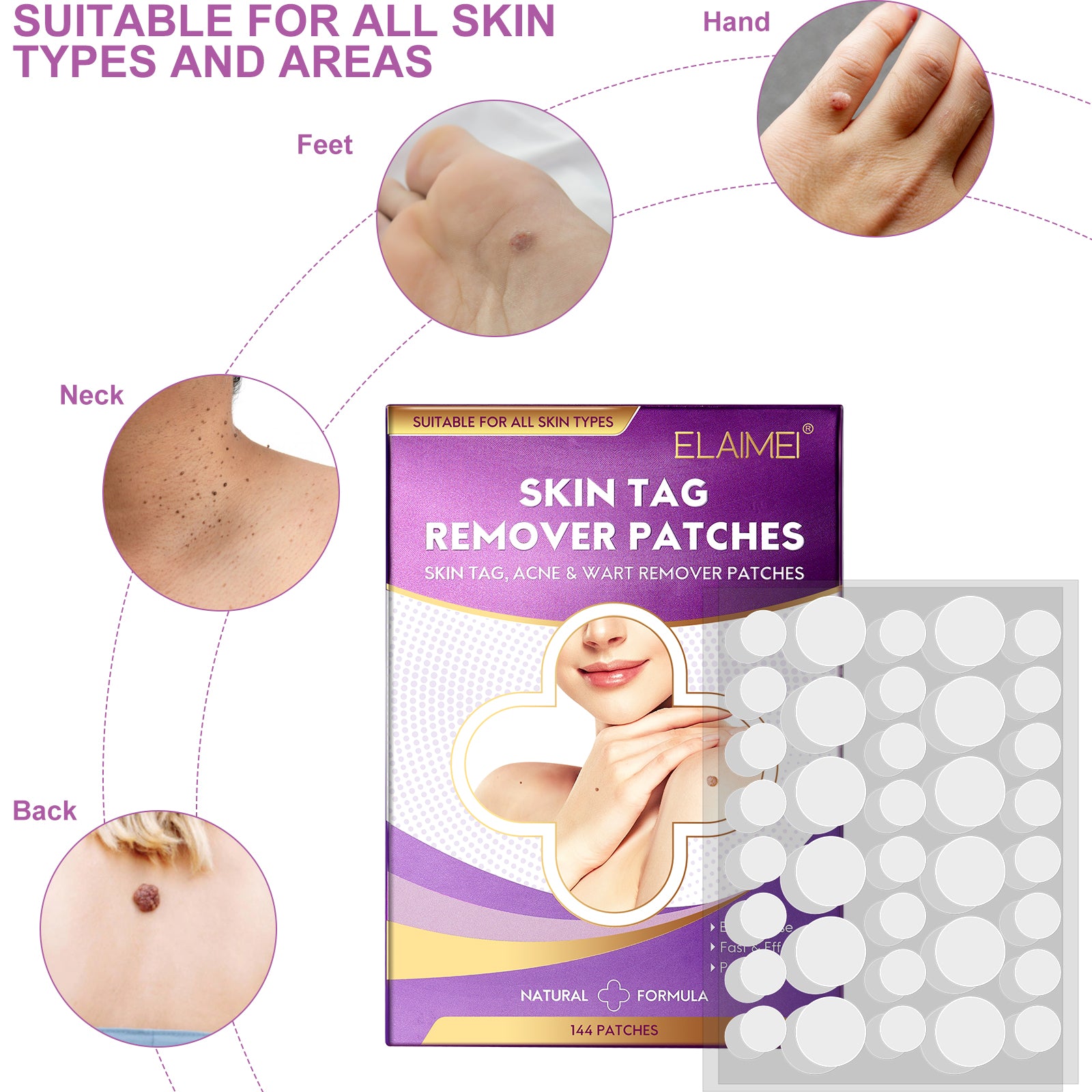 ELAIMEI Skin Tag, Acne & Wart Remover Patches, pack of 144pcs