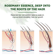 KIZENKA Rosemary Essential Oil, 60ml