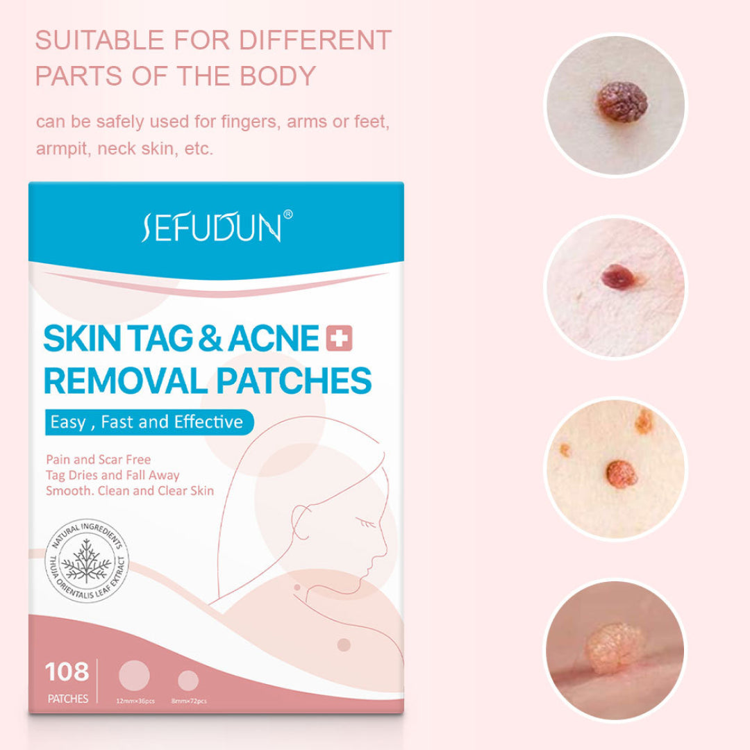 SEFUDUN Skin Tag & Acne Removal Patches, pack of 108pcs
