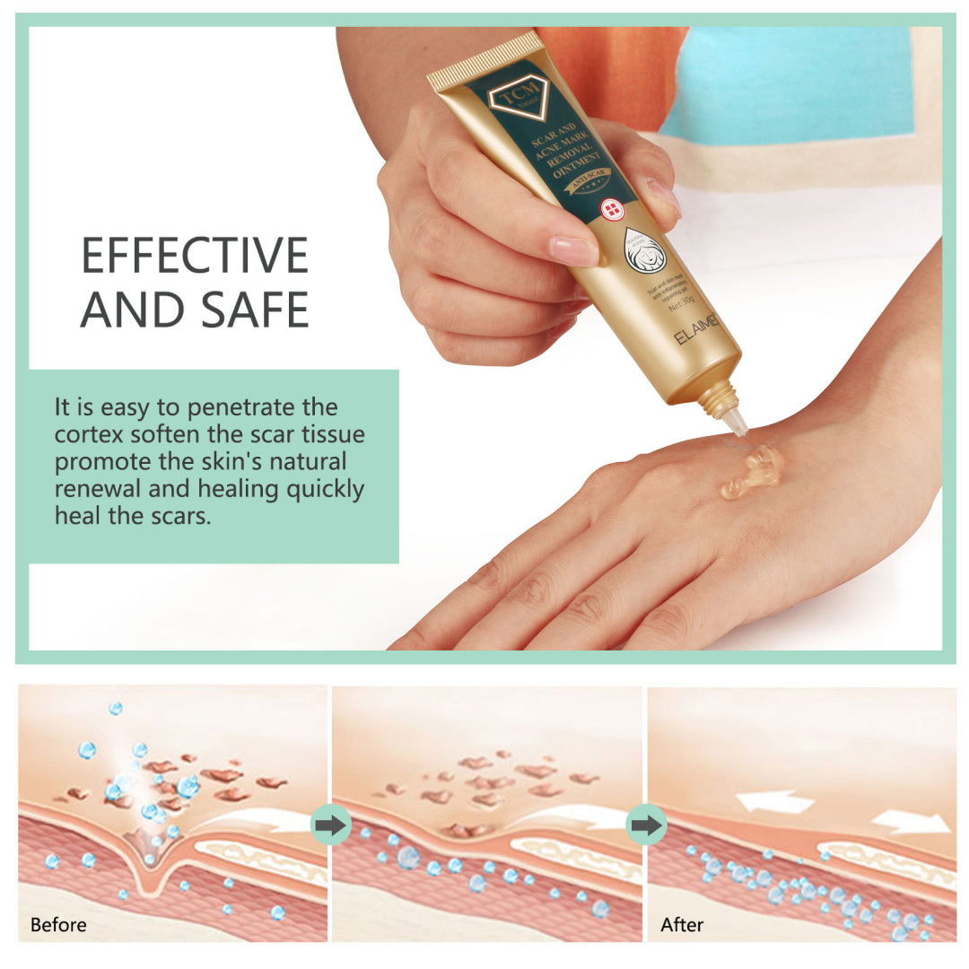 ELAIMEI TCM Scar And Acne Mark Removal Gel Cream, 30g