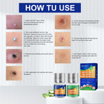 ALIVER 2in1 Effective Body Skin Tag Mole & Wart Removal Kit