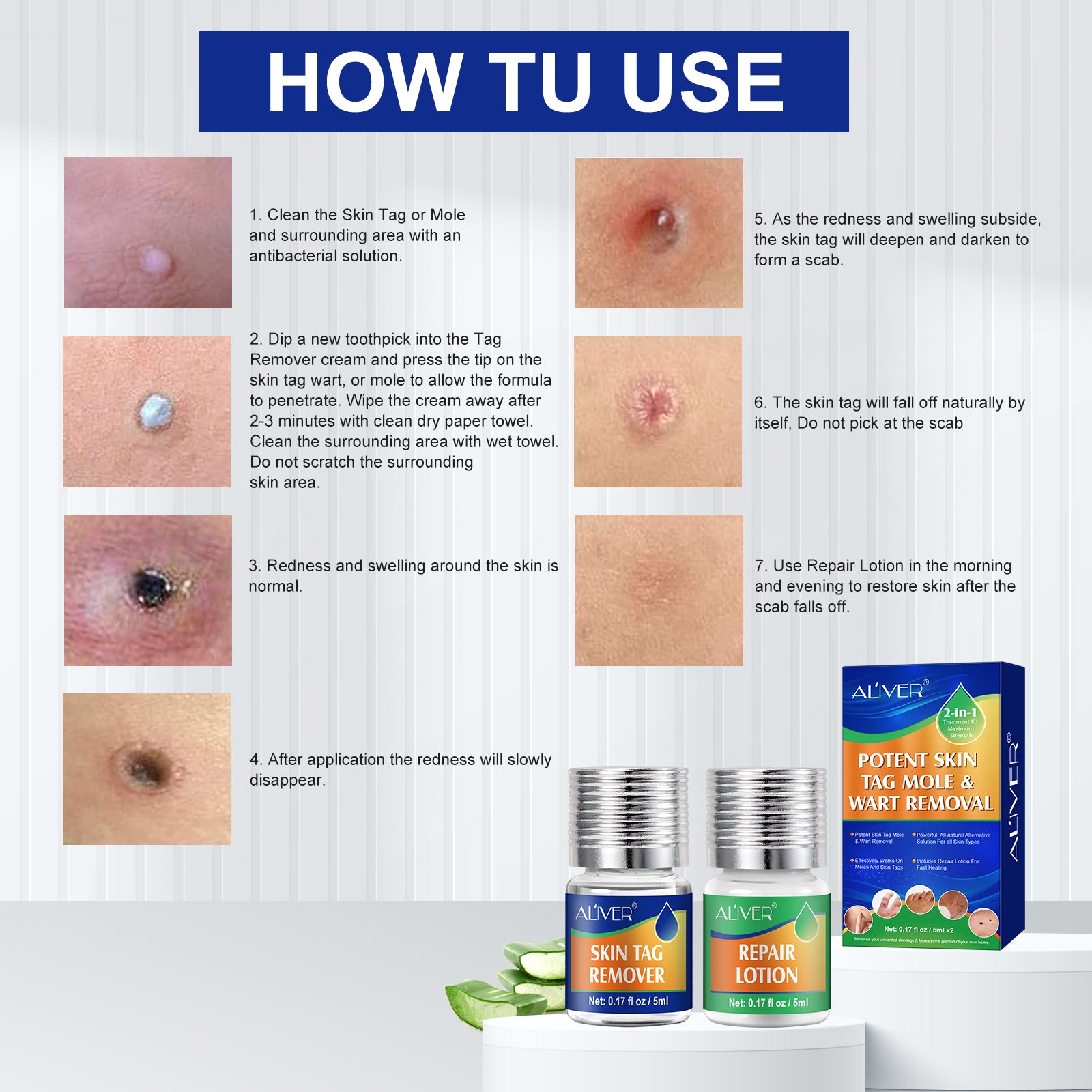 ALIVER 2in1 Effective Body Skin Tag Mole & Wart Removal Kit