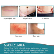 Elaimei Silicone Gel Sheet Roll for Scar Removal Treatment Tape 1.5M