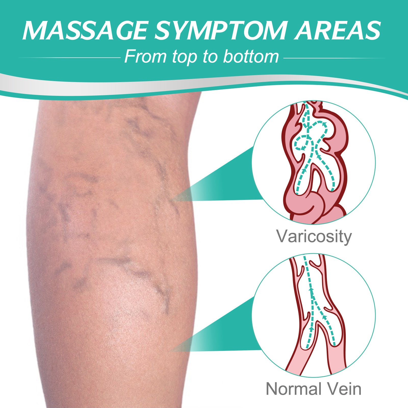 Varicose Veins Patch Treatment for Legs Relief Pain Vasculitis, Spider Vein Strengthen Capillary Health Blood Circulation Vein Care Fading  (8 count)