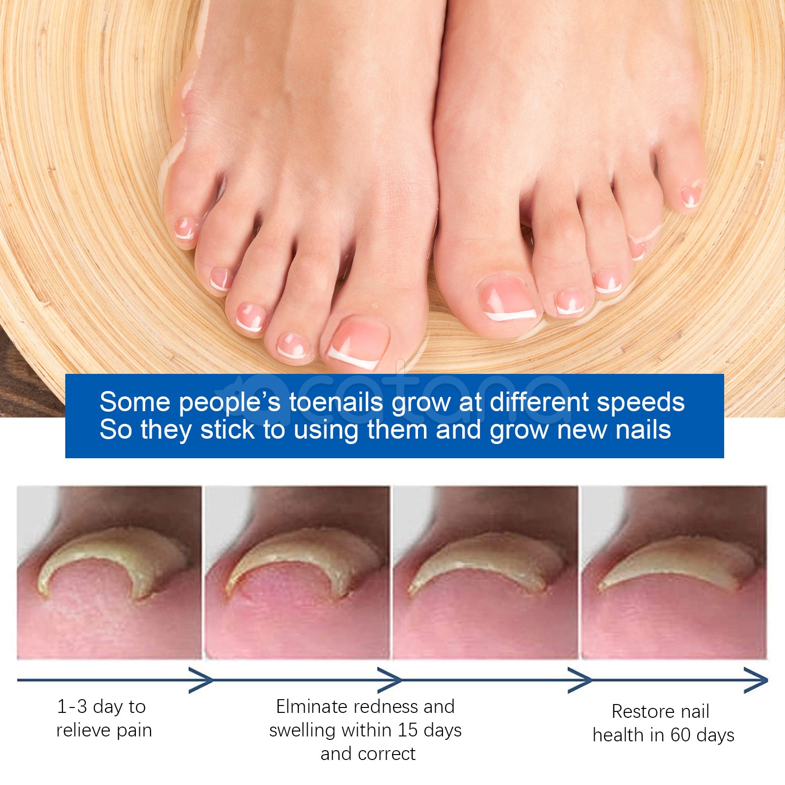 SEFUDUN Removal Paronychia Oil, 30ml