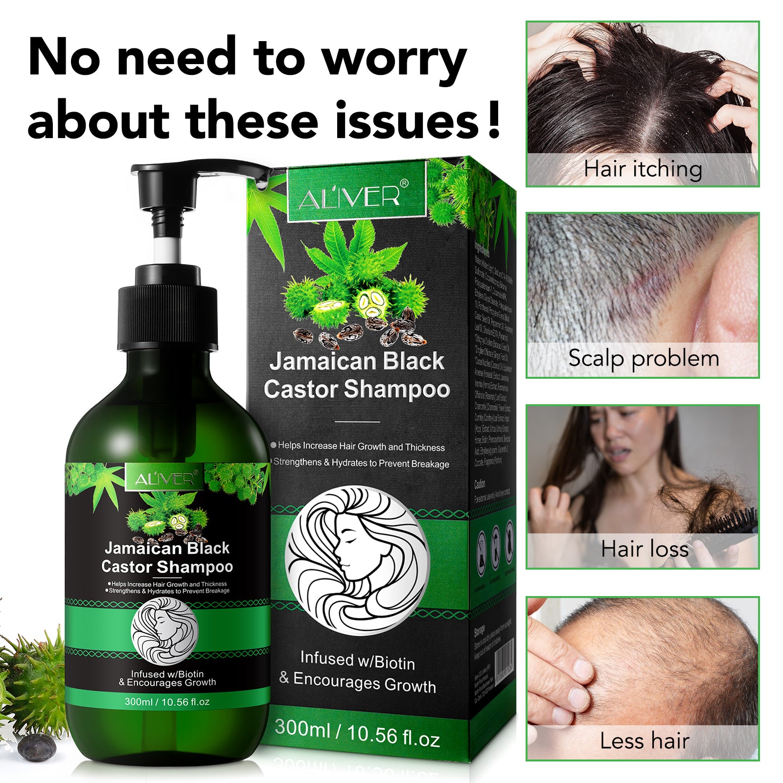 ALIVER Jamaican Black Castor Hair Growth Shampoo, 300ml