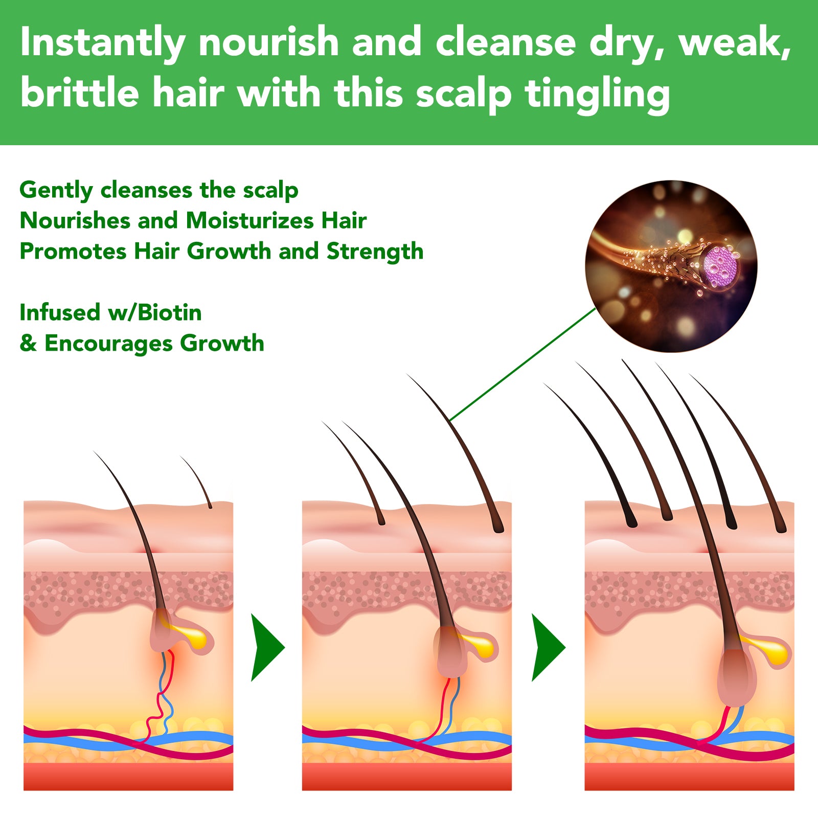 ALIVER Rosemary Hair Growth Shampoo, 300ml