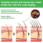 ALIVER Rosemary Hair Growth Shampoo, 300ml