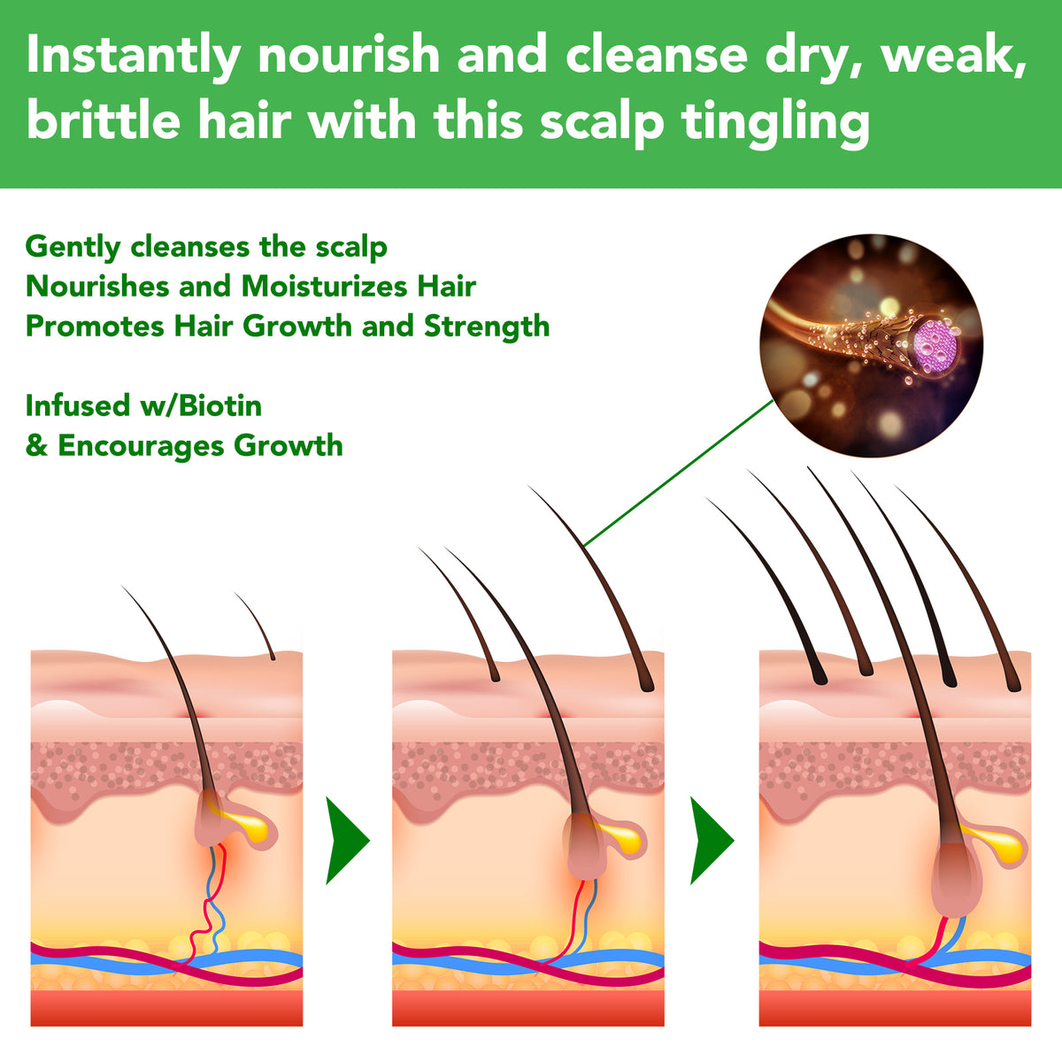 ALIVER Rosemary Hair Growth Shampoo, 300ml
