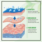 ELAIMEI Exfoliating Foot Peeling Spray with Green Tea Oil, 100ml