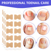 SEFUDUN Toenail Correction Stickers, pack of 100pcs