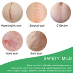 ALIVER Silicone Scar Sheets, Reduction Treatment, pack of 4pcs
