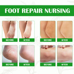 ELAIMEI Exfoliating Foot Peeling Spray with Green Tea Oil, 100ml