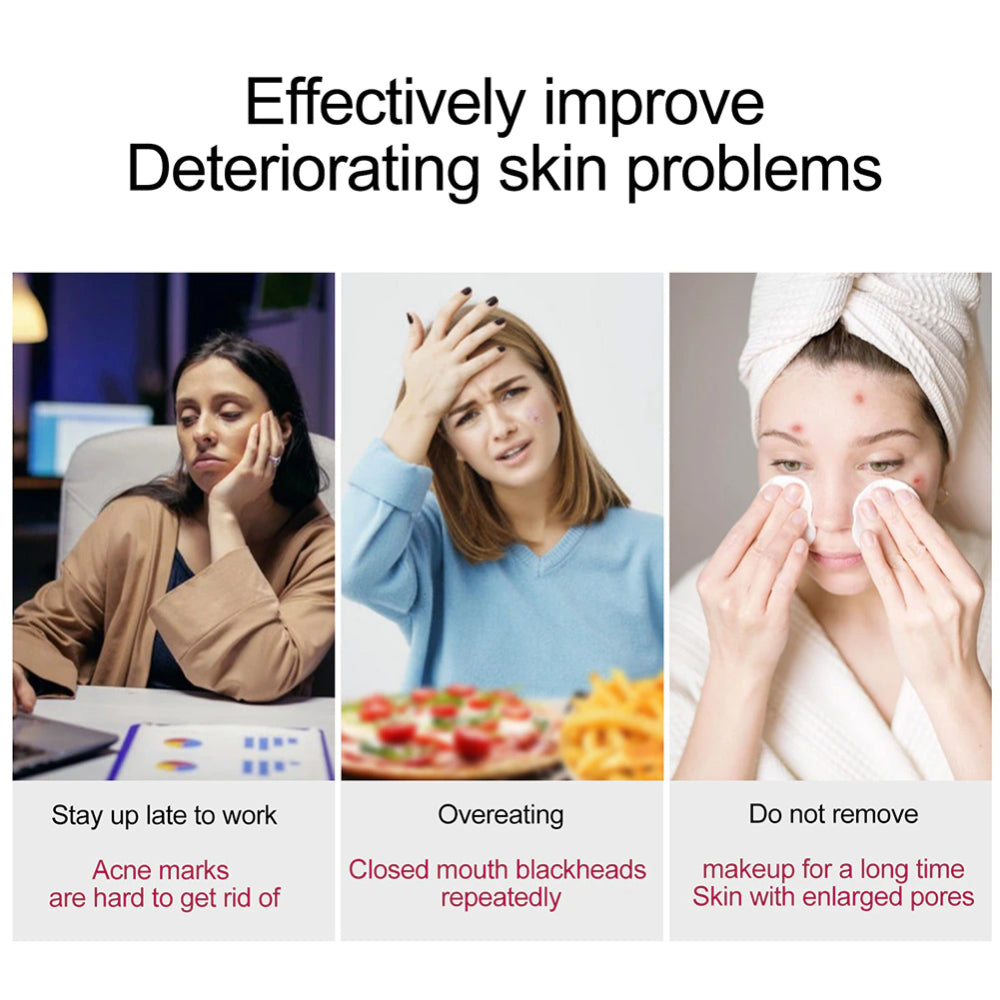 SEFUDUN AHA 30% & BHA 2% Salicylic Acid Serum, 30ml