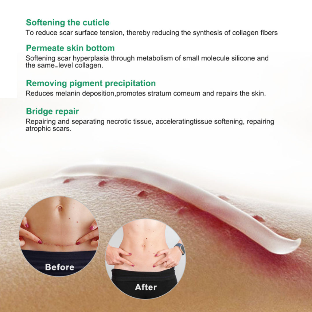 Aliver Treatment Scar Remove Cream for Body Face Skin