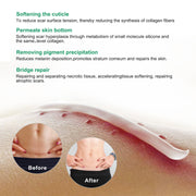 Aliver Treatment Scar Remove Cream for Body Face Skin