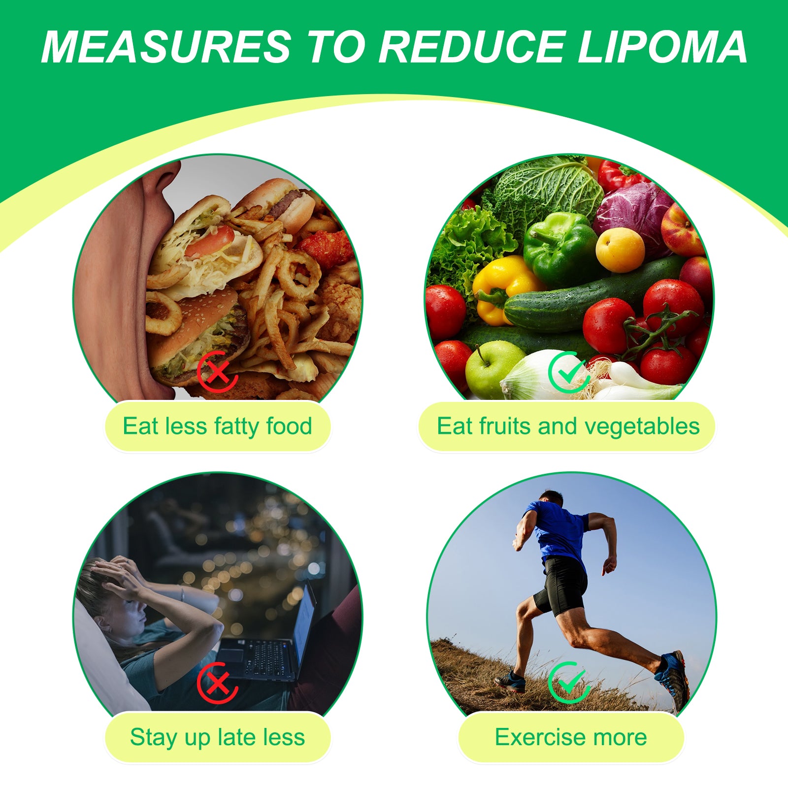 SEFUDUN Lipoma Removal Cream, 20g