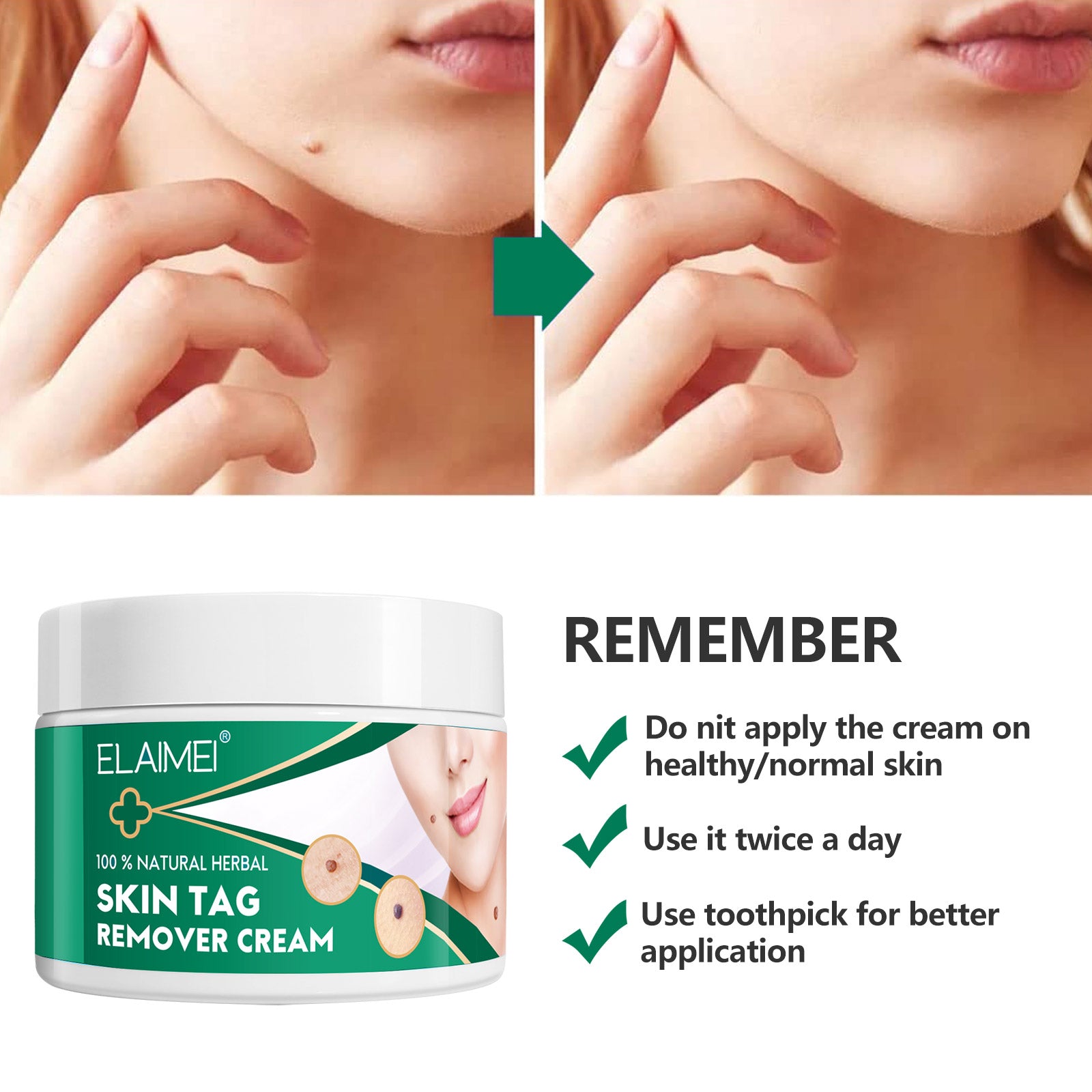 ELAIMEI Natural Herbal Skin Tag Remover Cream, 100g