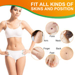 ALIVER Orange Skin Tag Remover Kit