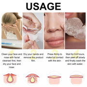 ELAIMEI Nose Pimple Patches, 12pcs
