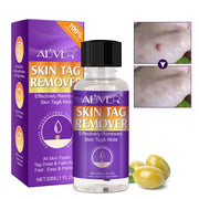 ALIVER Safe Skin Tag Removal Liquid, 30ml