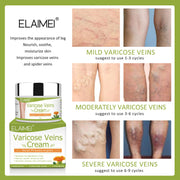 ELAIMEI Anti Varicose Veins Cream for Legs, 50g