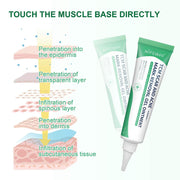 Nifeishi  Advanced Scar Removal Gel Cream Treatment Repair Acne Marks Ointment Skin Care