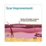 Aliver Silicone Gel Sheets for Scar Removal Treatment Repair