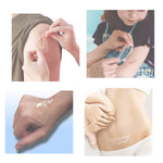 Aliver Silicone Gel Sheets for Scar Removal Treatment Repair